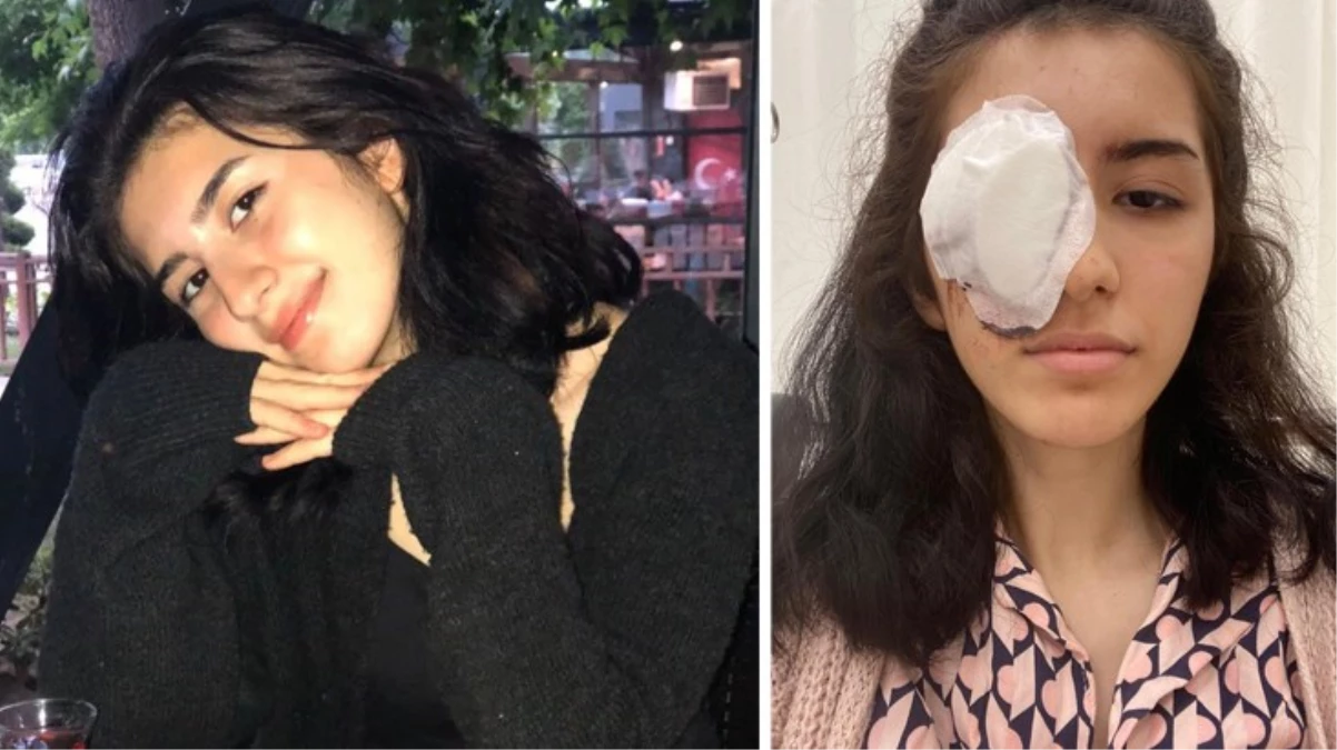 Evinin önünde otururken kanlar içinde kaldı! Maganda kurşunu 16 yaşındaki kızı kör etti