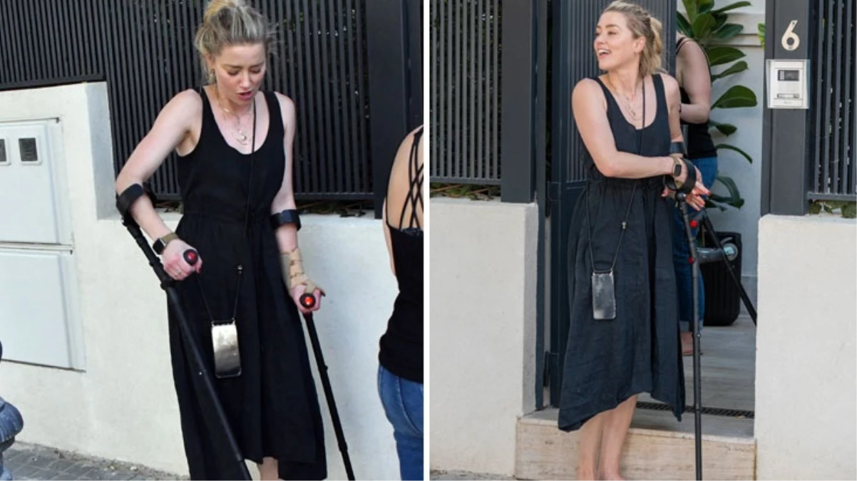 Johnny Depp’e açtığı davayı kaybettikten sonra İspanya’ya taşınan Amber Heard’ün koltuk değnekli hali sevenlerini korkuttu