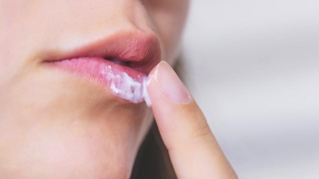 Dudakta uçuk neden çıkar, nasıl geçer? Stresten dudak uçuklaması hangi hastalığın belirtisidir?