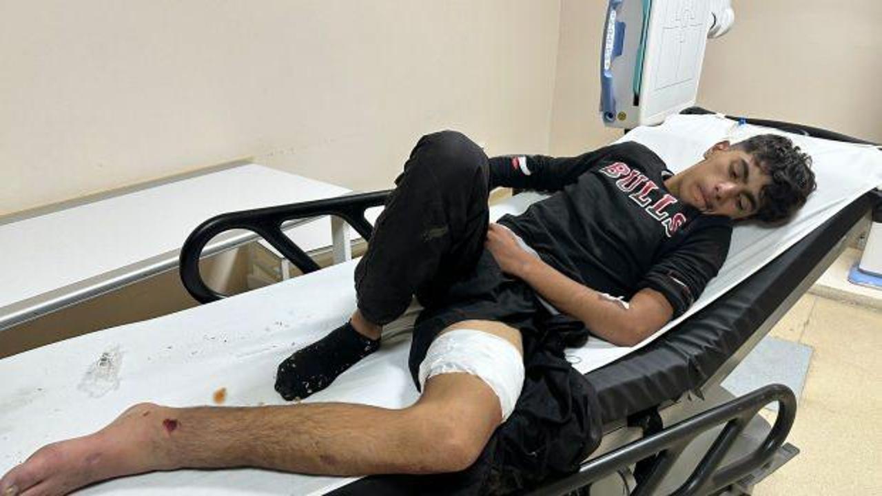 Erzurum’da bozayı çocuğa saldırdı: Ayıya yumruk attım, beni bırakıp kaçtı