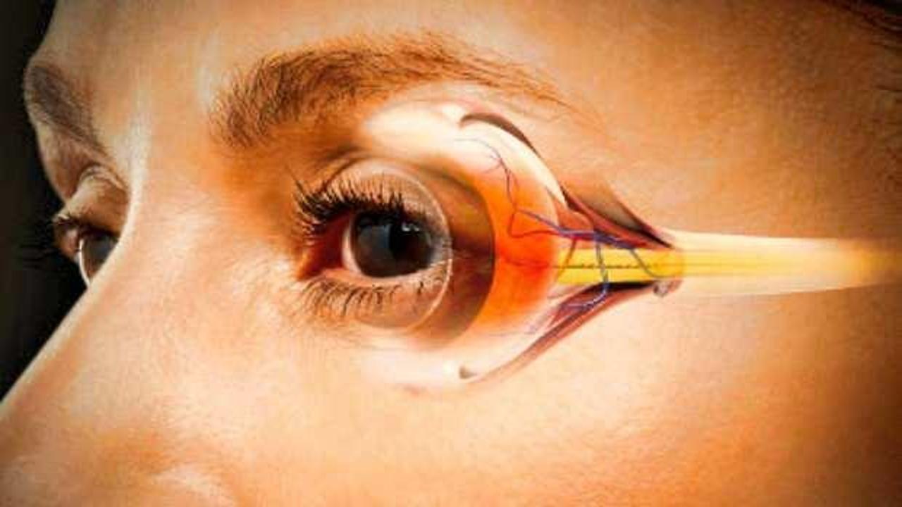 Şahin gibi gözler için bu 10 besin şart! Gözün görme gücünü artıran besinler…