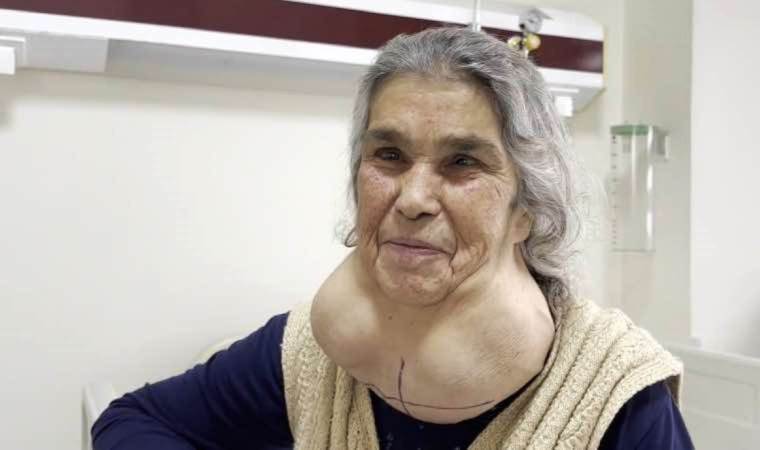 50 yıldır doktor korkusundan hastaneye gitmiyordu…Devasa kitle ile yaşadı!