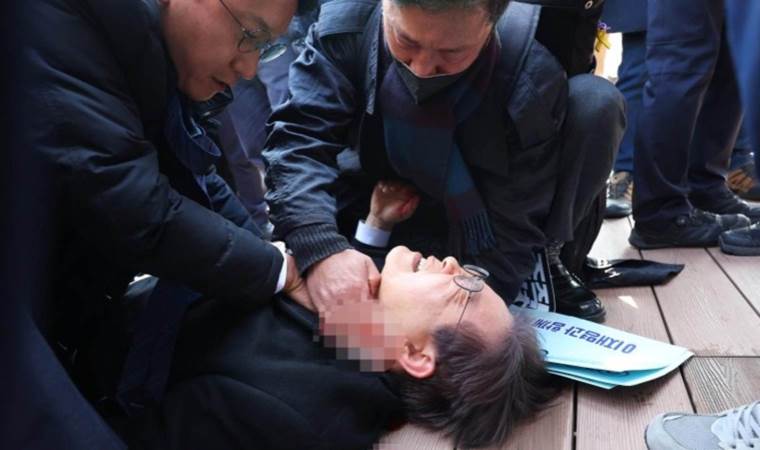 Boynundan bıçaklanmıştı: Ana muhalefet lideri ameliyat oldu