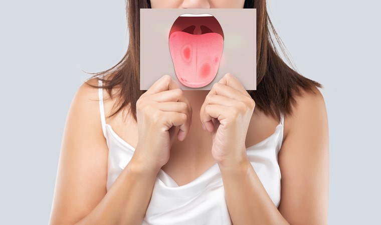 Diliniz aynada böyle görünüyorsa dikkat! Dildeki renk değişimi hangi hastalıkların habercisi?