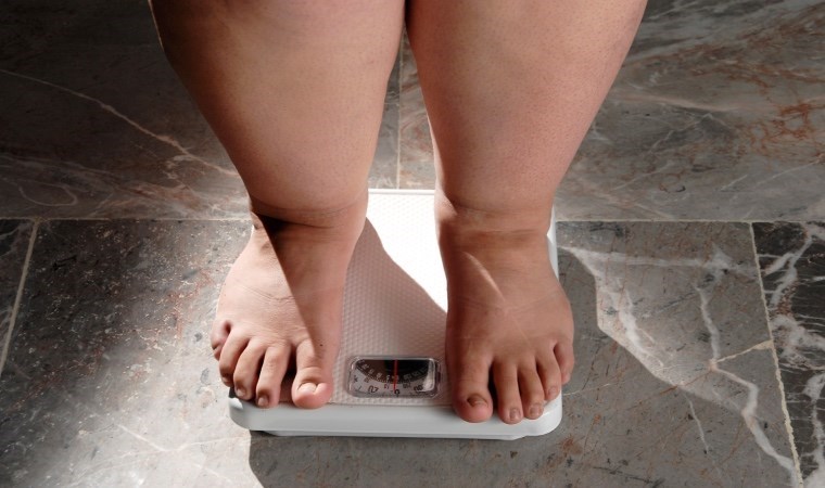 İnsanlığın obezite sınavı