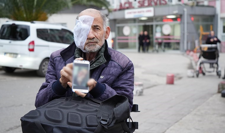 Yüzü eriyen adam tedavi olmak istiyor: ‘Suratım mum gibi eriyor’
