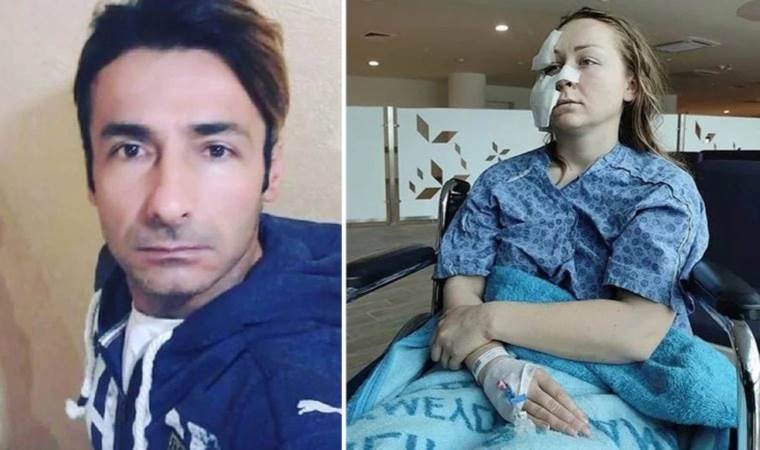 Eşinin yüzünü falçatayla kesen erkeğe istenen ceza belli oldu