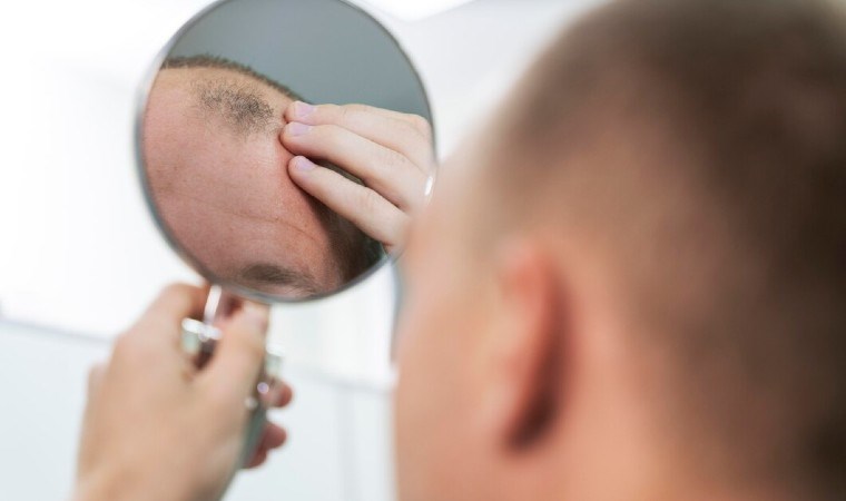 Uzmanlar uyarıyor: Saç problemlerinize duşta yaptığınız bu 6 hata sebep oluyor olabilir...