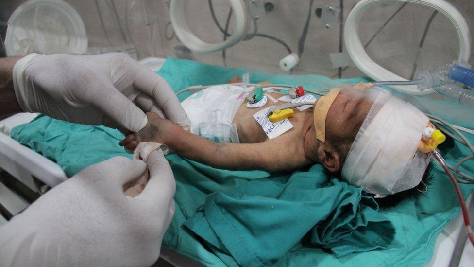 Bebeği açlıktan ölen Gazzeli baba: 'Oğlum zaten öldü, diğer bebekler ne olacak?'