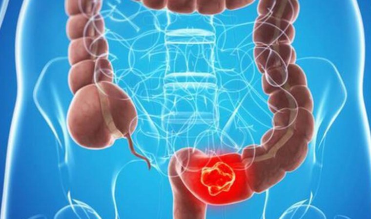 Bağırsaklarınızı temizleyecek 7 besin: Tıkalı bağırsağı anında açıyor!