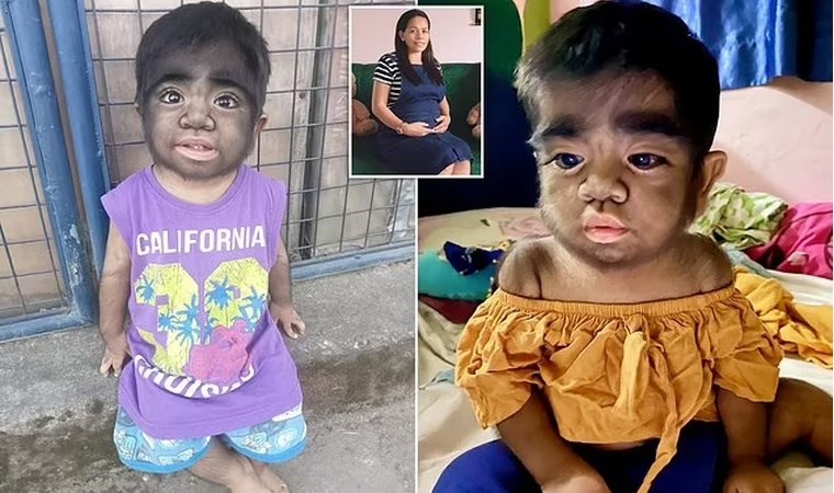 Milyarda bir görülüyor: Dünya’nın en kıllı bebeği iki yaşında!